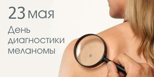 В России проходит День меланомы