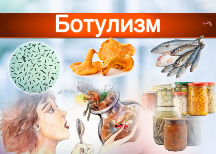 Что такое ботулизм?